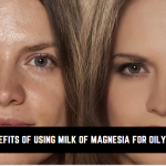 10 Benefits Of Using Milk Of Magnesia For Oily Skin